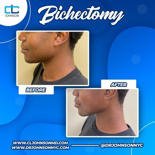 010531A1-BA86-4DB1-9DCE-6153F2F7496A-comp